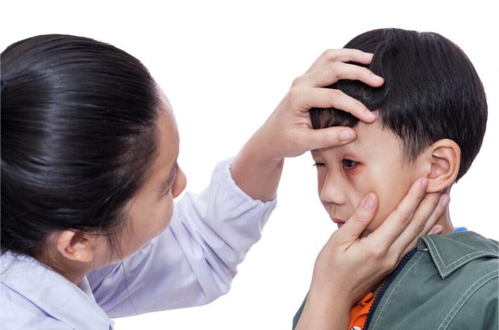 Apply eye injury first aid if possible. If not, seek the help of an eye doctor.